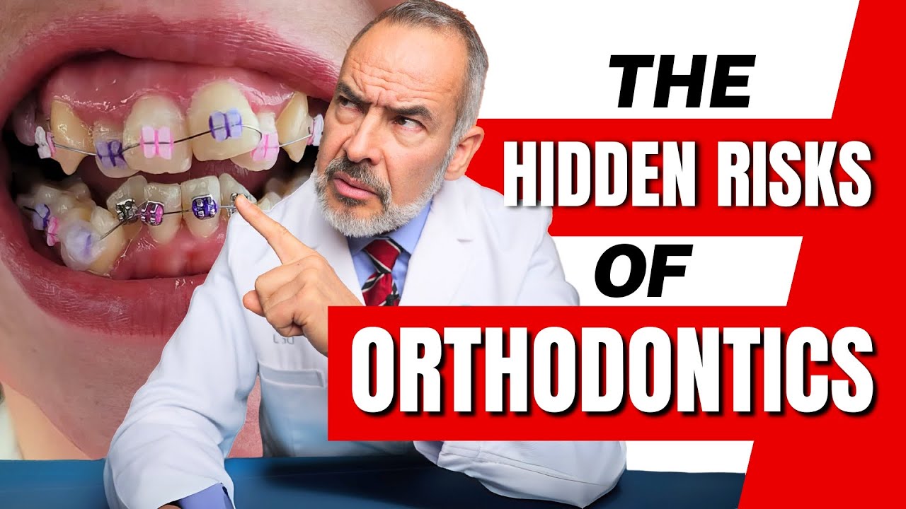 The Hidden Dangers of Braces (And What Orthodontists Won’t Tell You!)