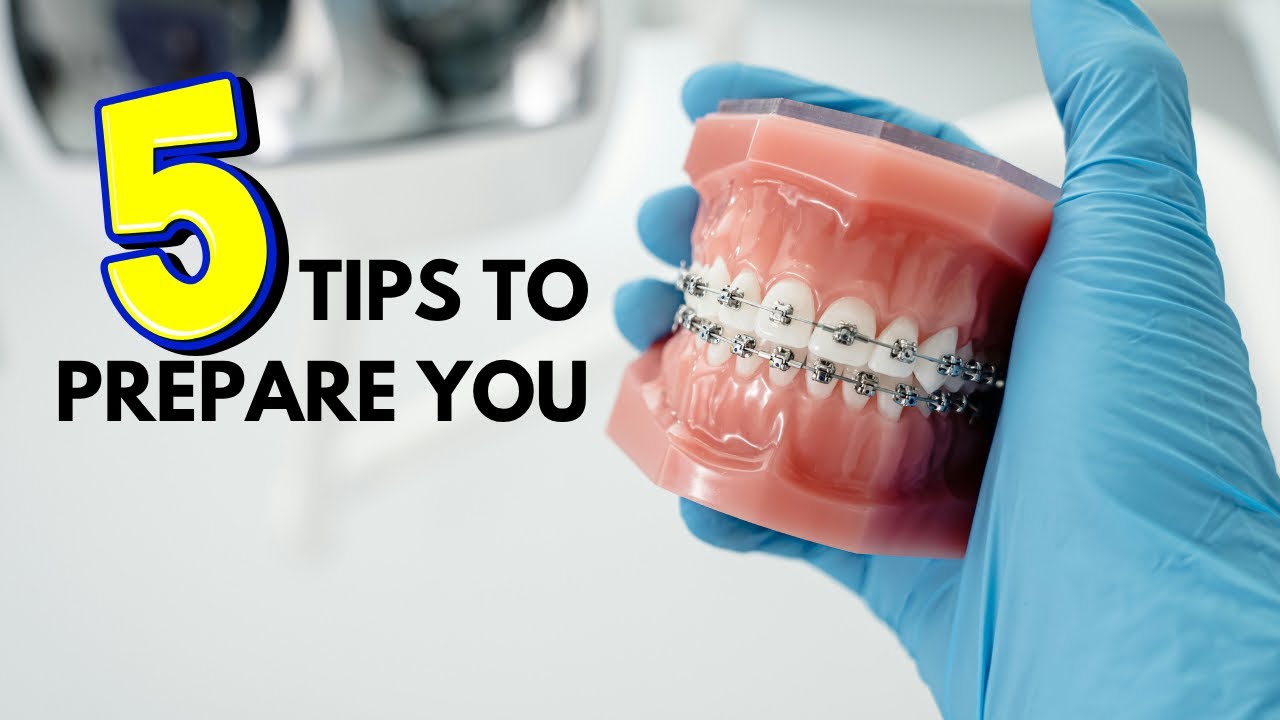 What to Know Before Getting Braces | 5 Tips to Prepare You