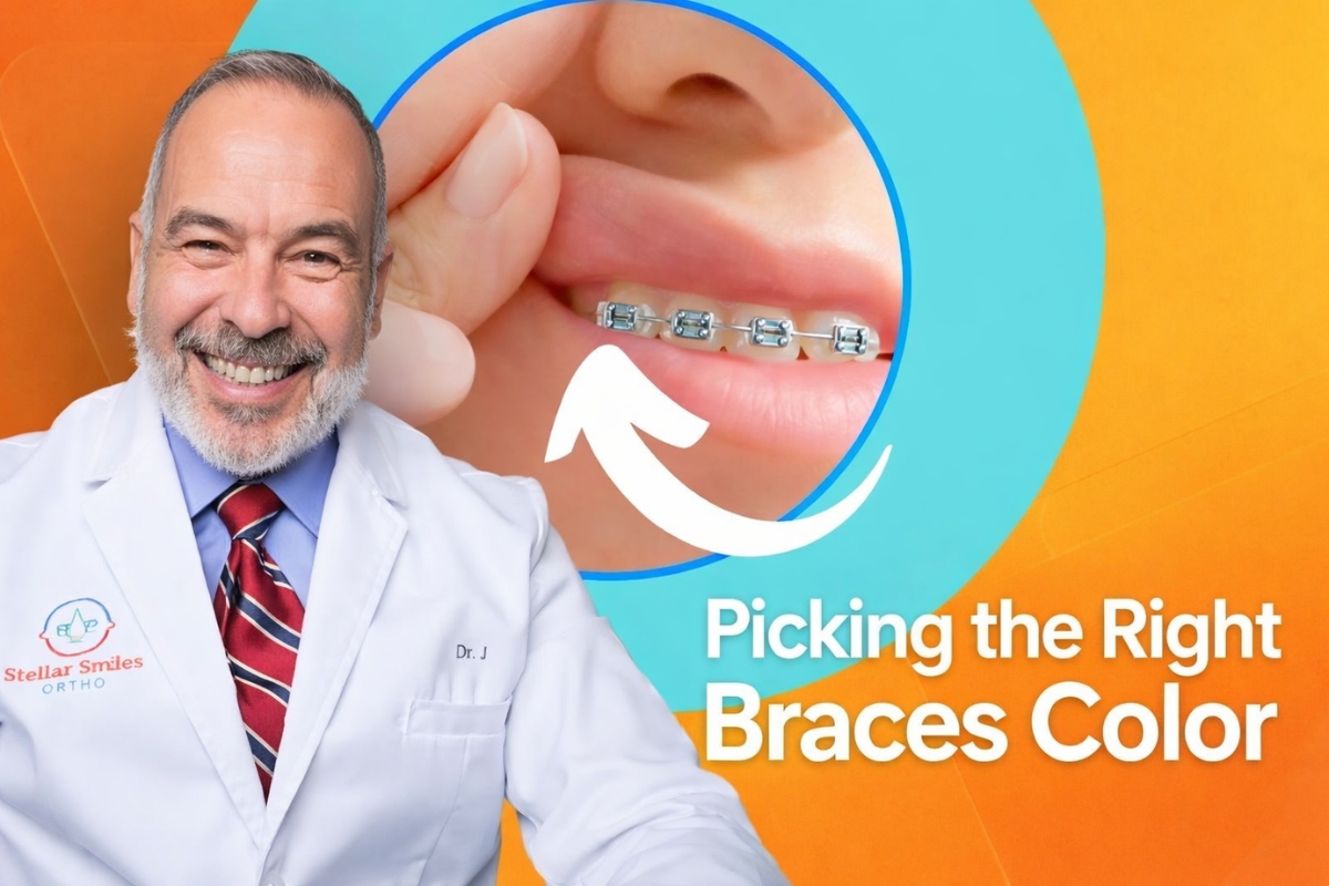 Best Color for Braces by Skin Tone & Style