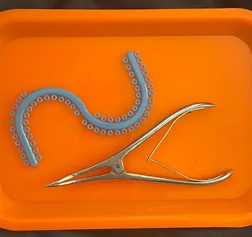img-Traditional Orthodontic Appliances_