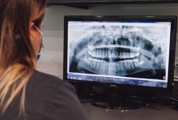 img-technology-Digital X-Rays
