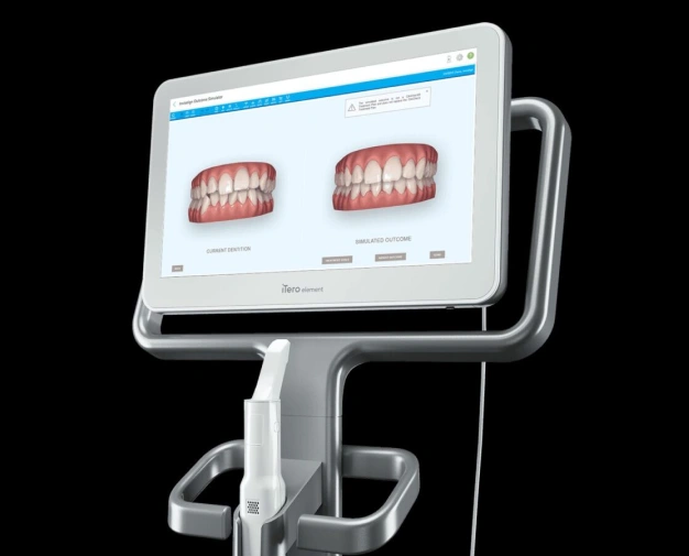 img-all-about-retainers-Why-Do-I-Need-a-Retainer