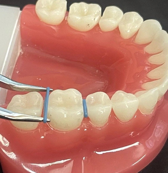 img-orthodontic-treatment-phases-Orthodontic separators