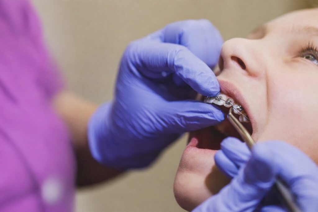 Professional Orthodontist Performing Braces on a Kid