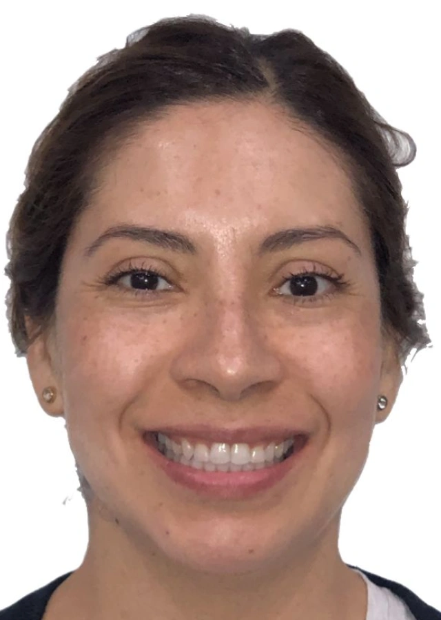 Adrianna - Adult comprehensive orthodontic treatment after