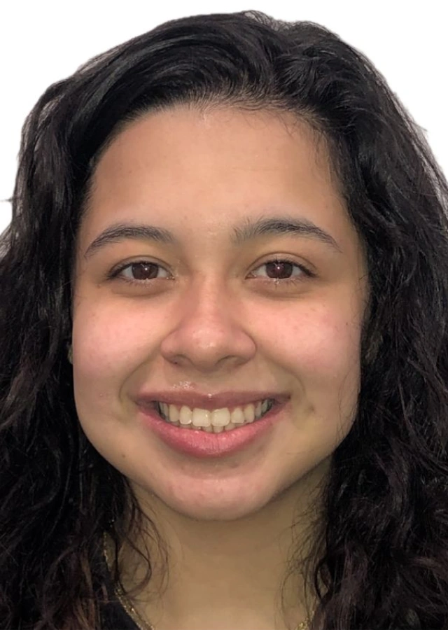 Jazmin - Adult comprehensive orthodontic treatment after