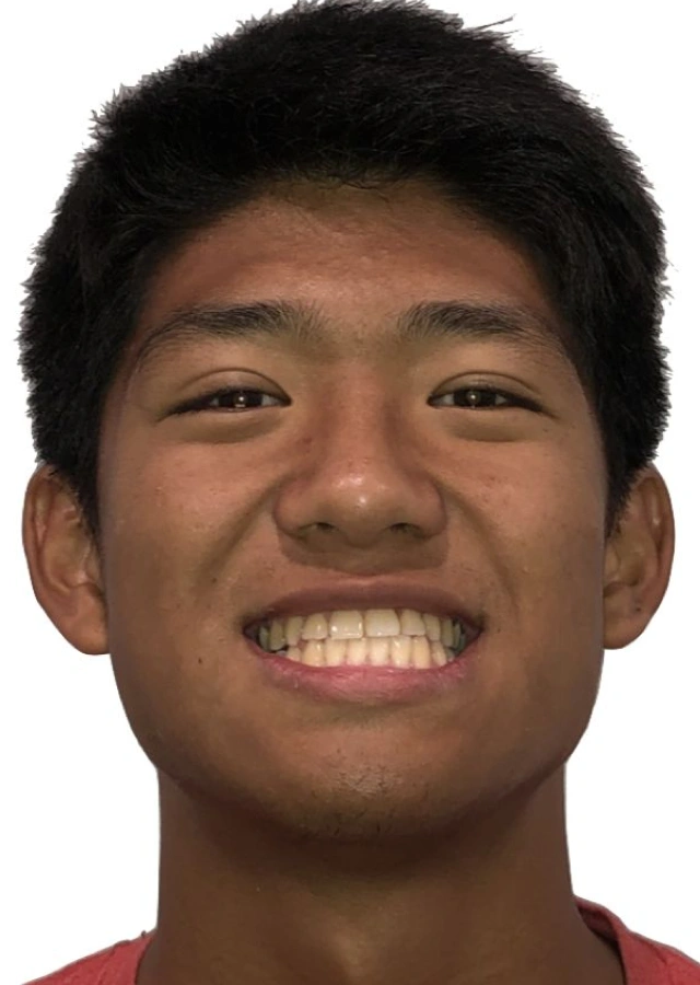 Samuel - Teen omprehensive orthodontic treatment after
